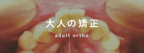 大人の矯正 adult ortho